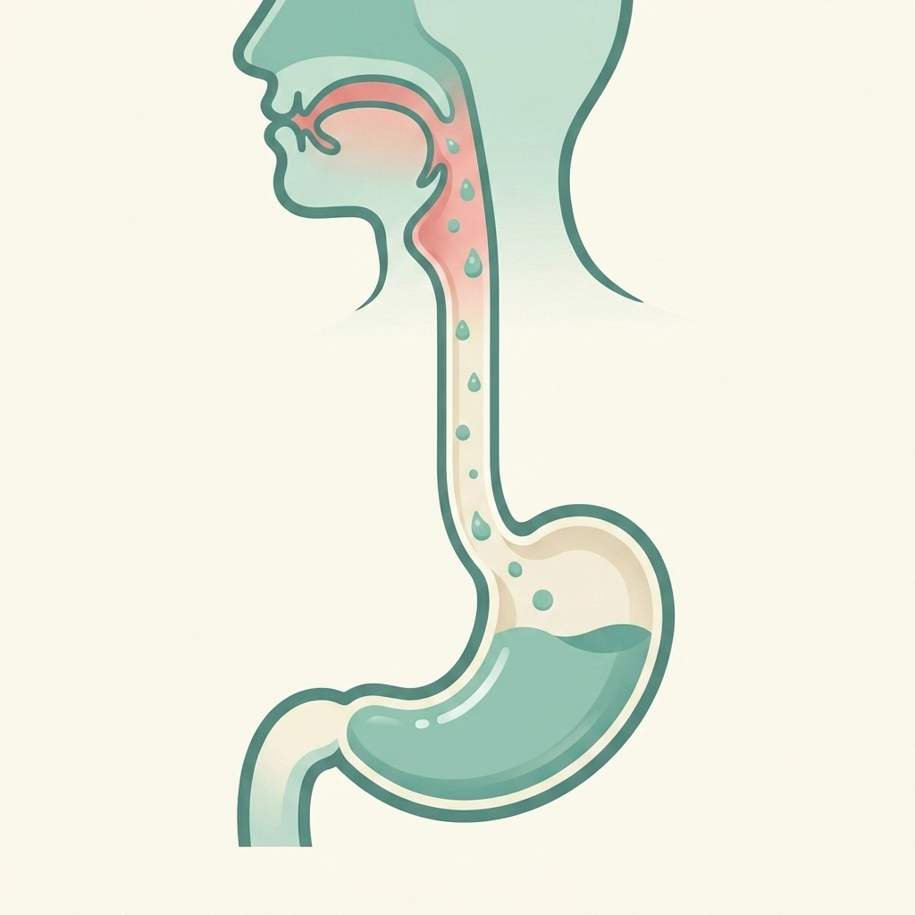 Illustration of pepsin droplets rising from the stomach to the bare, irritated throat